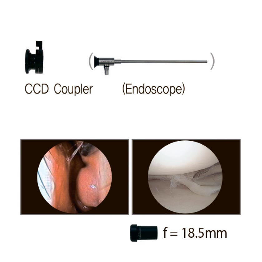 Endoscopic Camera System